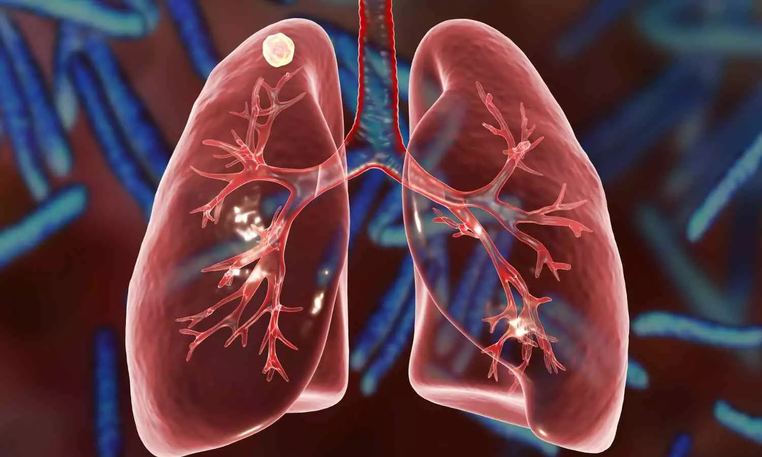 Image representing lungs