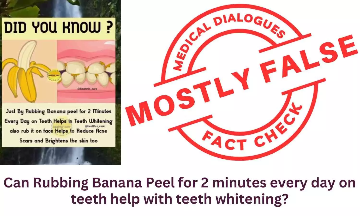 Fact Check: Can Rubbing Banana Peel on teeth for 2 minutes every day help with teeth whitening?