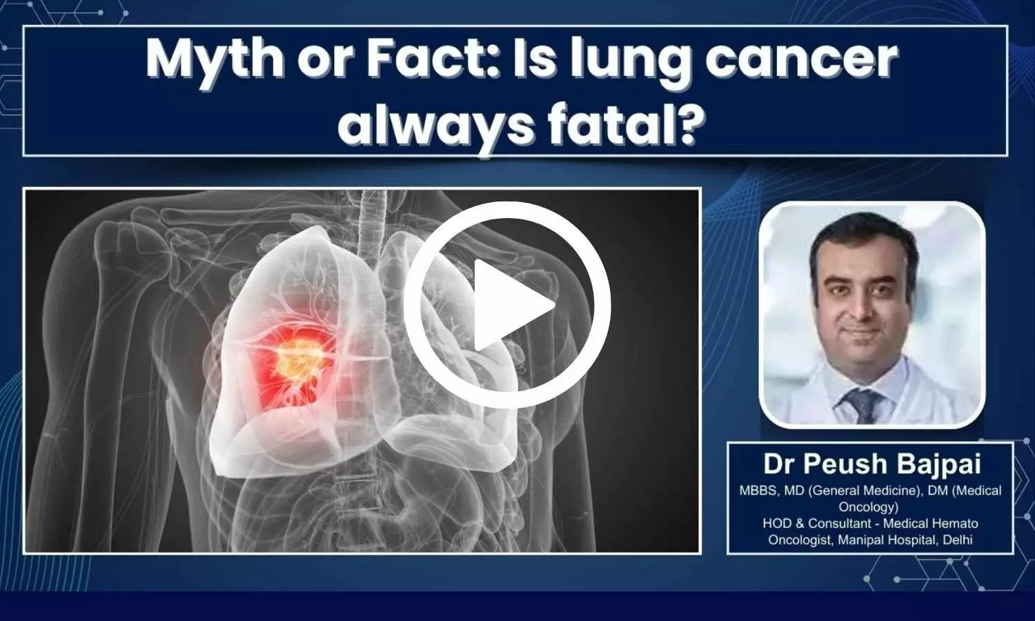 Featured image of video on lung cancer myths