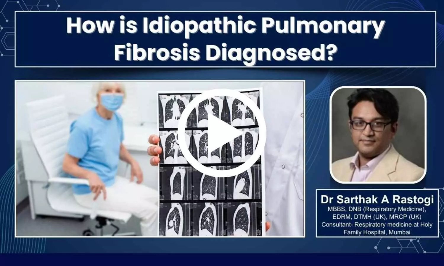 Featured image for video on Idiopathic Pulmonary Fibrosis diagnosis