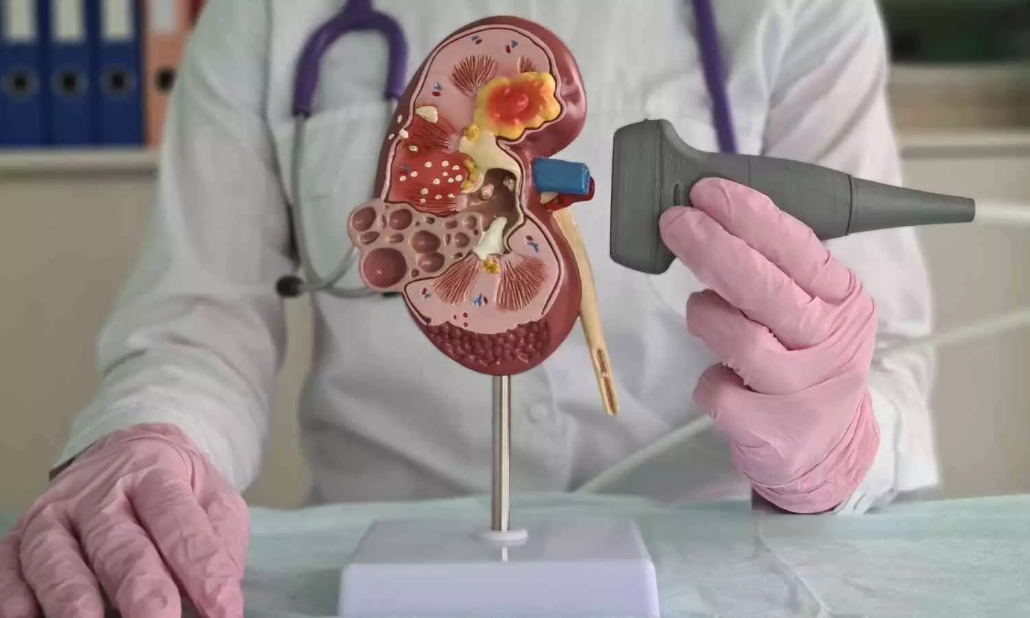 Image representing Kidney