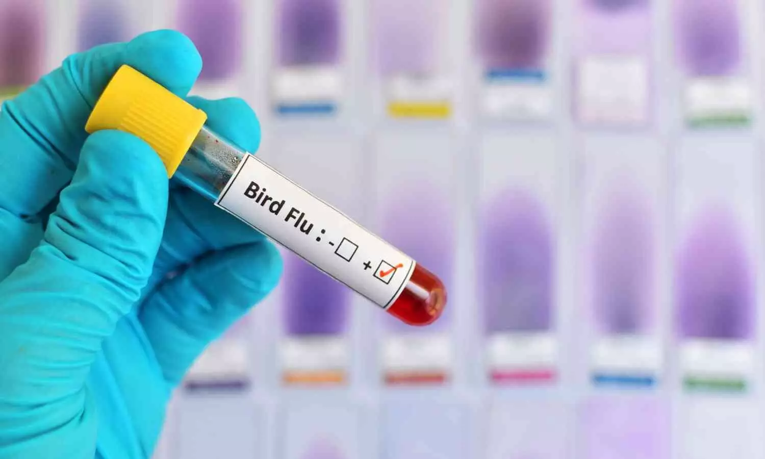 Image representing bird flu test