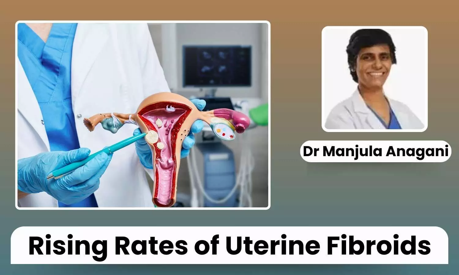 Featured image representing Uterine Fibroids