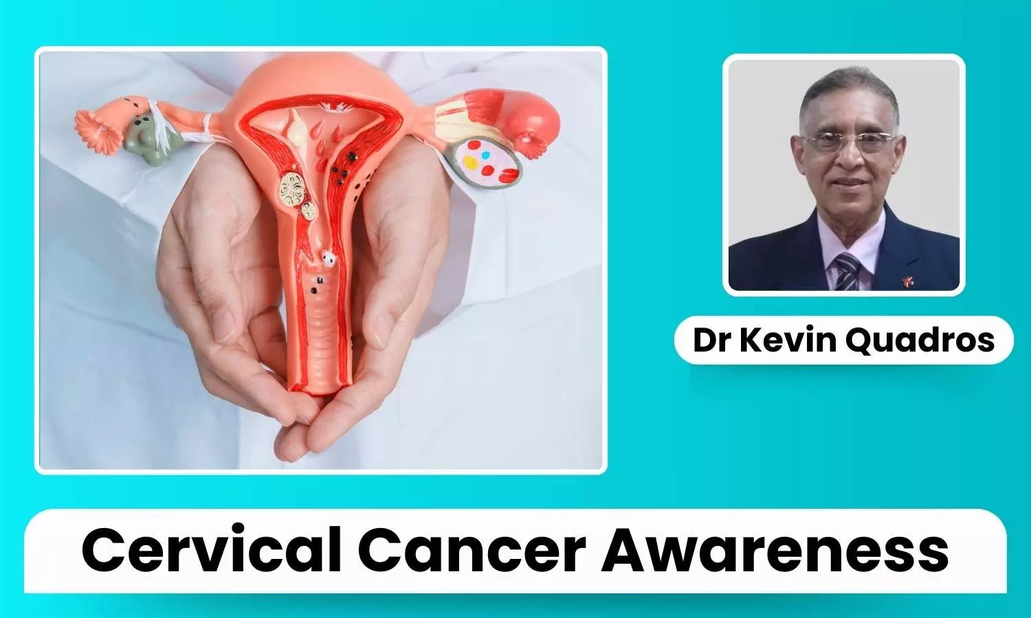 Featured Image representing Cervical Cancer Awareness