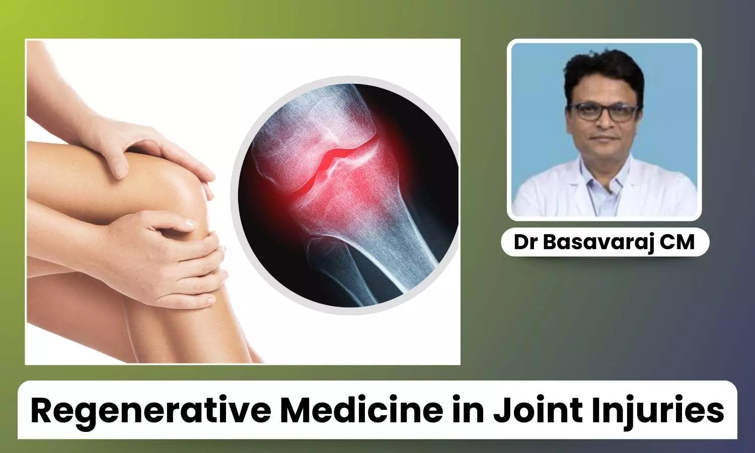 Featured image representing joint injury