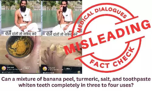Fact Check: Can Banana Peel, Turmeric, and Toothpaste completely Whiten Teeth in 3–4 Uses? Fact Check: Can Banana Peel, Turmeric, and Toothpaste completely Whiten Teeth in 3–4 Uses?