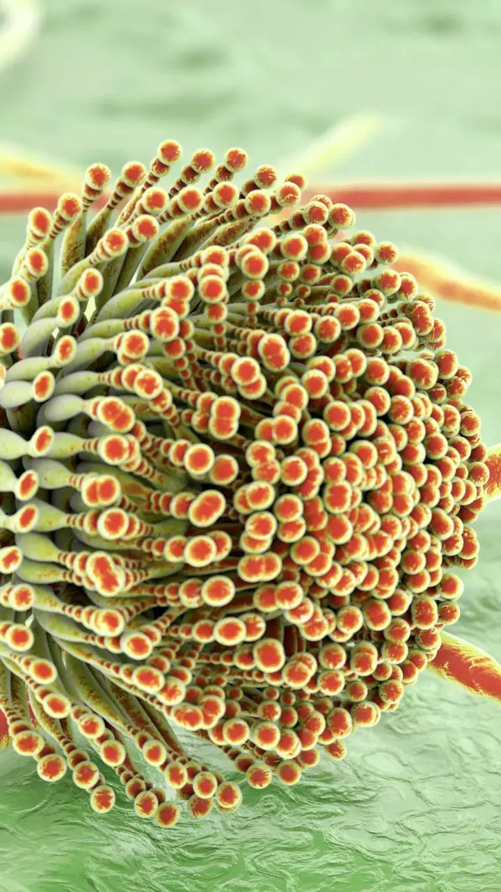 World Aspergillosis Day 2025: How This Fungal Infection Affects Your Health