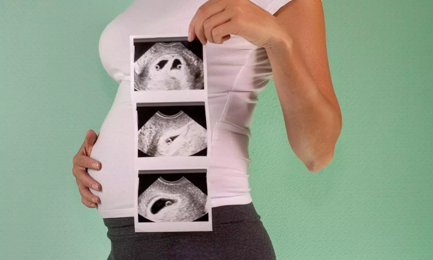 Image representing twin pregnancy