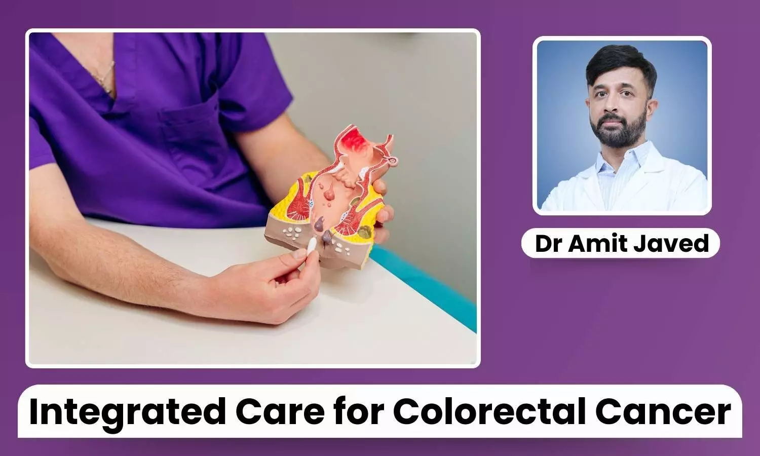 Featured image representing Colorectal health