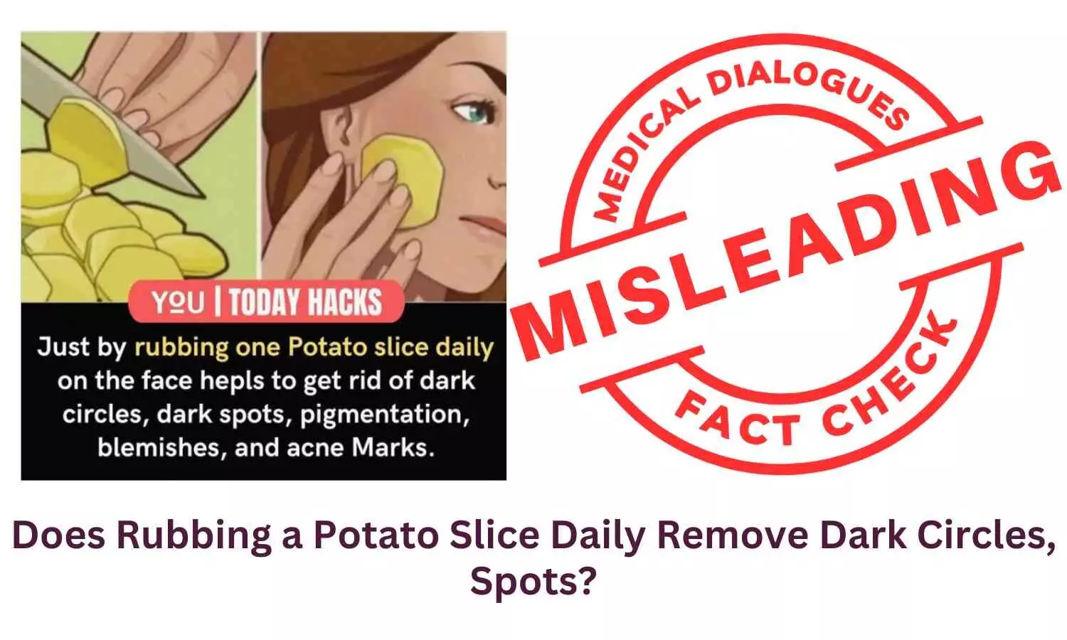 Fact Check: Does Rubbing a Potato Slice Daily Remove Dark Circles and Spots?