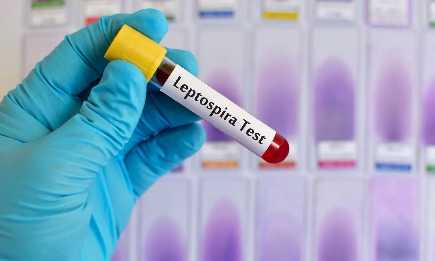 Image representing Leptospira test