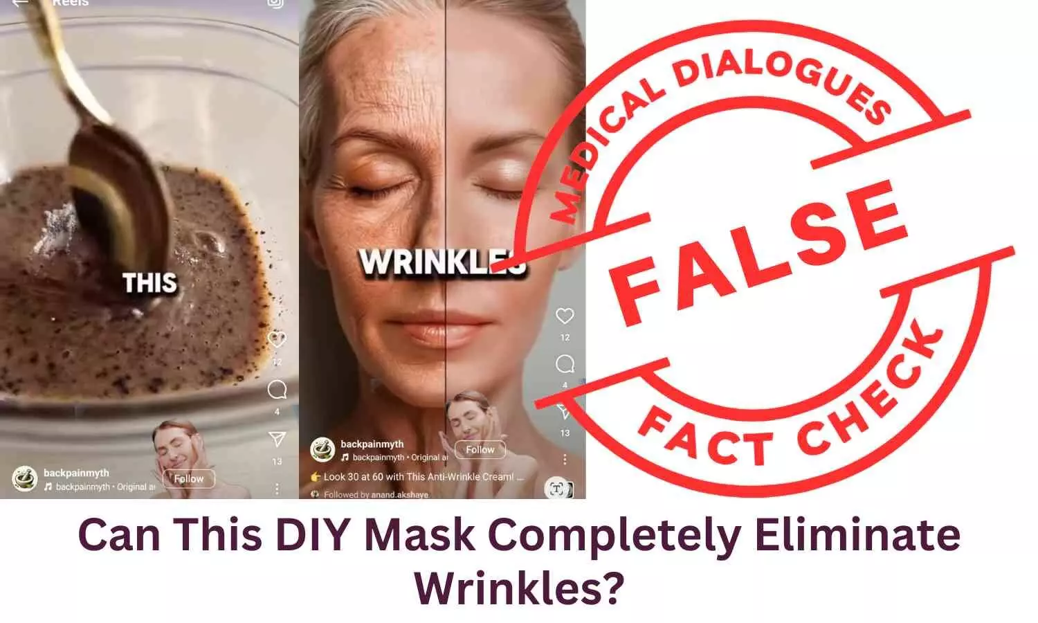 Fact Check: Can This DIY Mask Completely Eliminate Wrinkles?