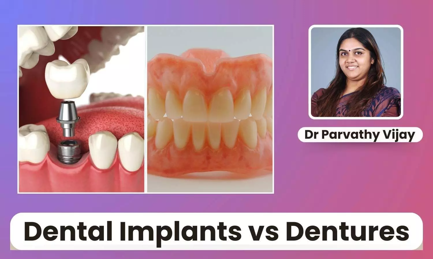 Featured image representing dental implants and dentures