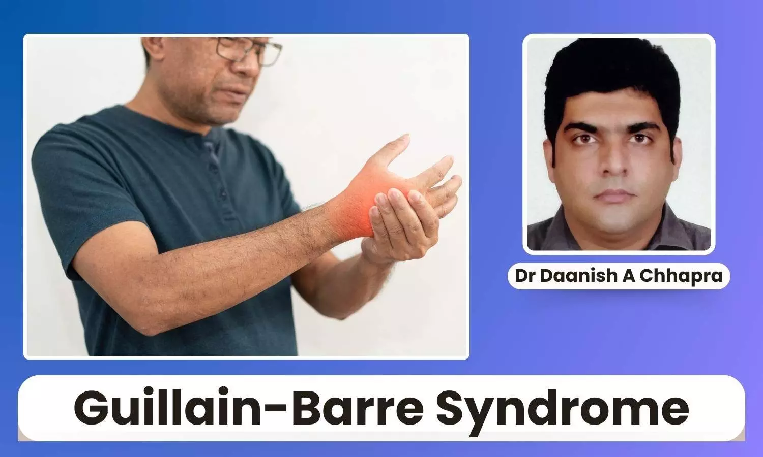 Featured image representing guillain barre syndrome