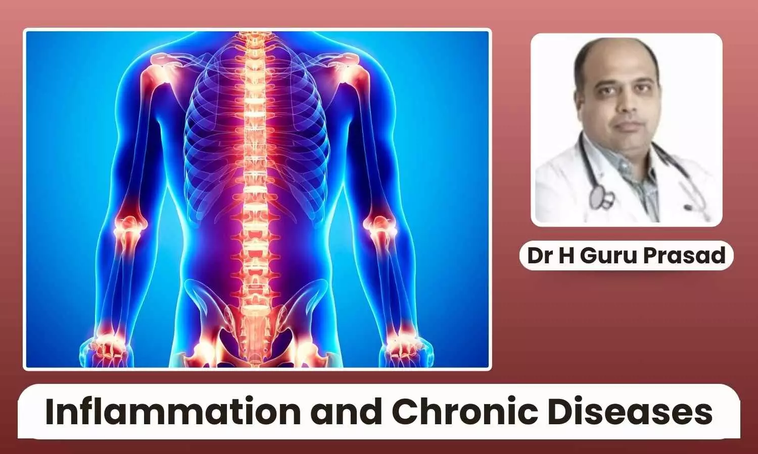 Featured image representing inflammation