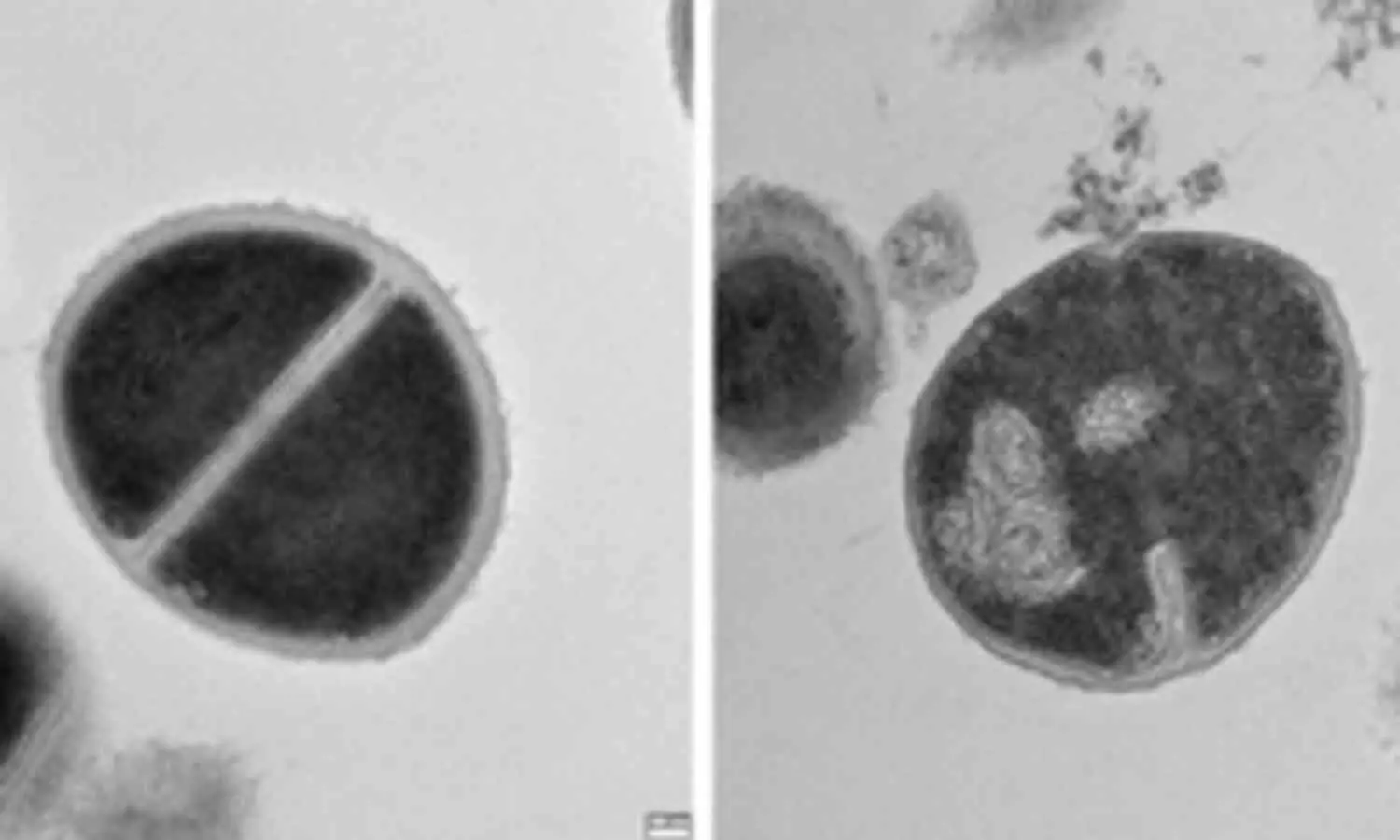 Study Finds Human Protein Recycling System Acts as Natural Antibiotic Against Bacteria