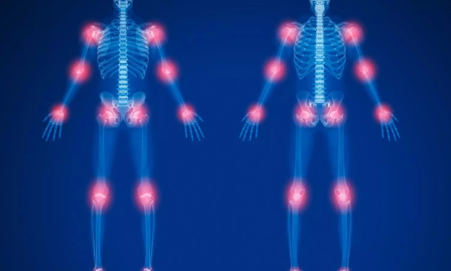 Image representing joint health