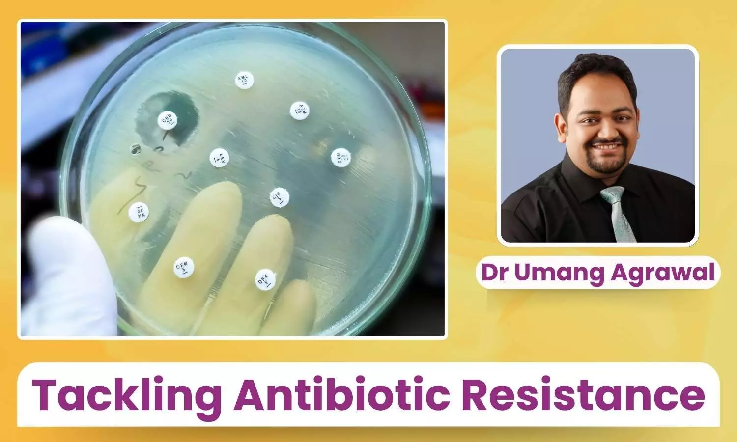 Tackling Antibiotic Resistance: What can Doctors and Patients do? - Dr Umang Agrawal Tackling Antibiotic Resistance: What can Doctors and Patients do? - Dr Umang Agrawal