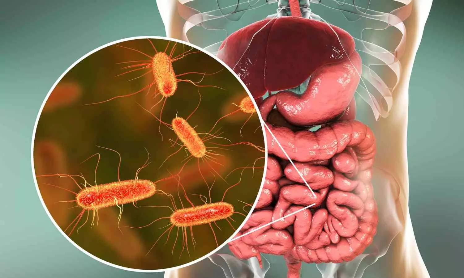 Non-Antibiotic Drugs May Harm Gut Microbiome and Raise Infection Risk: Yale Study Non-Antibiotic Drugs May Harm Gut Microbiome and Raise Infection Risk: Yale Study