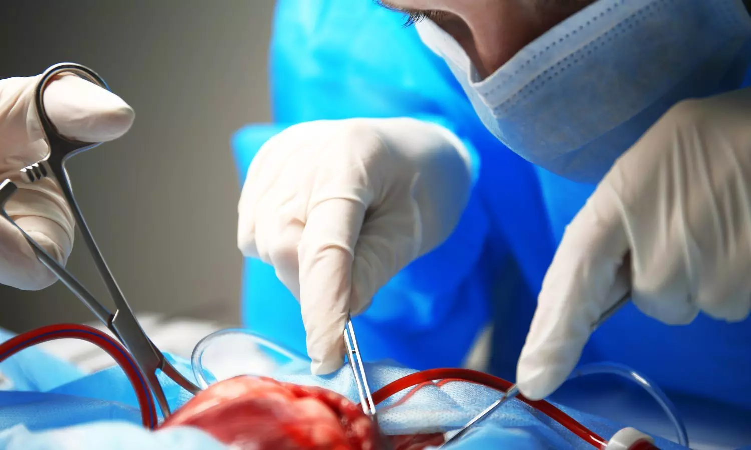 Fortis Hospital, Mulund Performs Successful Heart Transplant on 58-Year-Old Ex-Army Serviceman