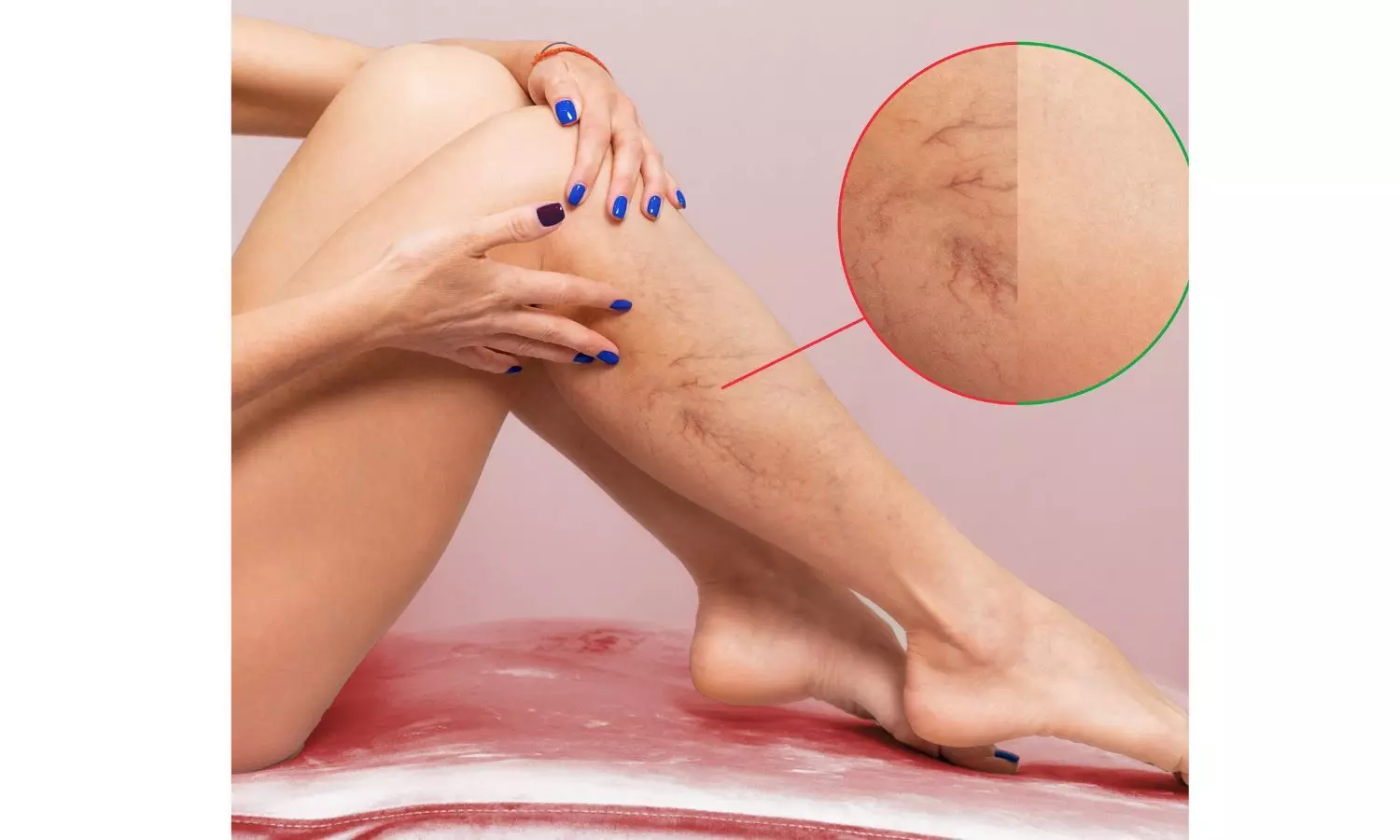 World Thrombosis Day