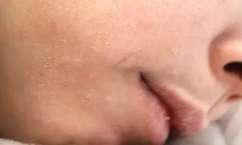 बार-बार सर्दी-जुकाम और रूखी त्वचा? हो सकती है विटामिन सी की कमी, ऐसे करें दूर