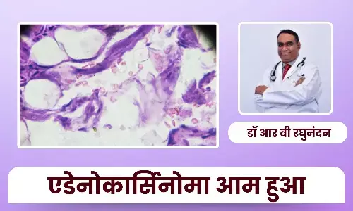 एडेनोकार्सिनोमा कैसे बन गया भारत में सबसे आम फेफड़े का कैंसर - डॉ आर वी रघुनंदन