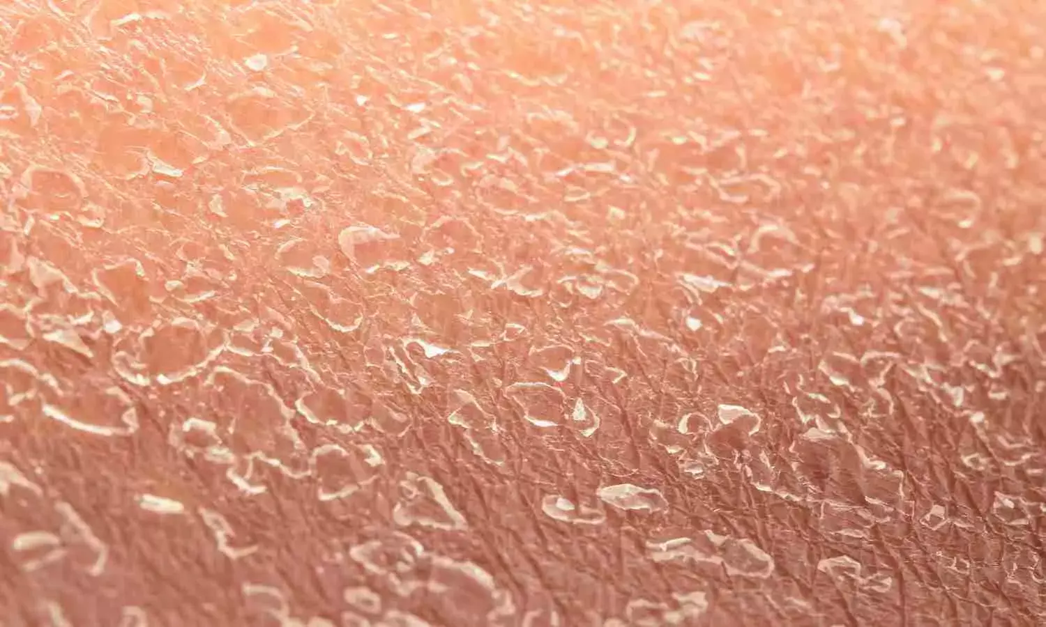 सर्दियों में रूखी त्वचा से परेशान? घर पर बनाएं नेचुरल स्क्रब और पाएं चमकदार त्वचा