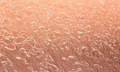 सर्दियों में रूखी त्वचा से परेशान? घर पर बनाएं नेचुरल स्क्रब और पाएं चमकदार त्वचा