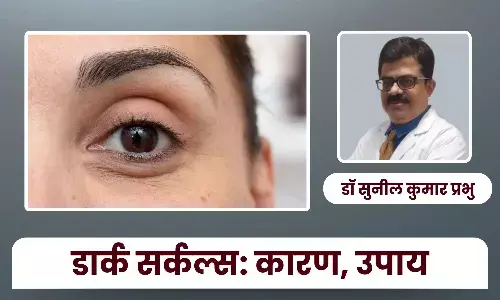 डार्क सर्कल्स क्यों होते हैं और इन्हें कैसे कम करें - डॉ सुनील कुमार प्रभु