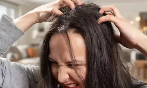 सिर से जूं को तुरंत खत्म करेंगे ये दो कारगर उपाय, खुजली और डैंड्रफ से भी मिलेगी राहत