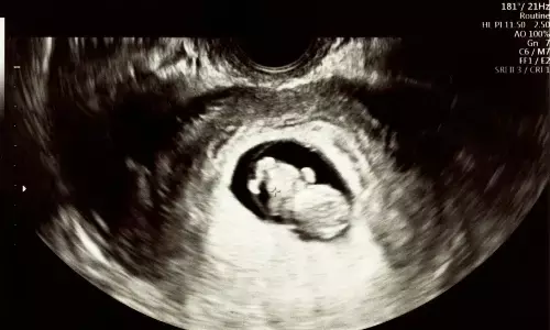 Study Links Pregnancy Antibiotics to Higher Bacterial Disease Risk in Infants