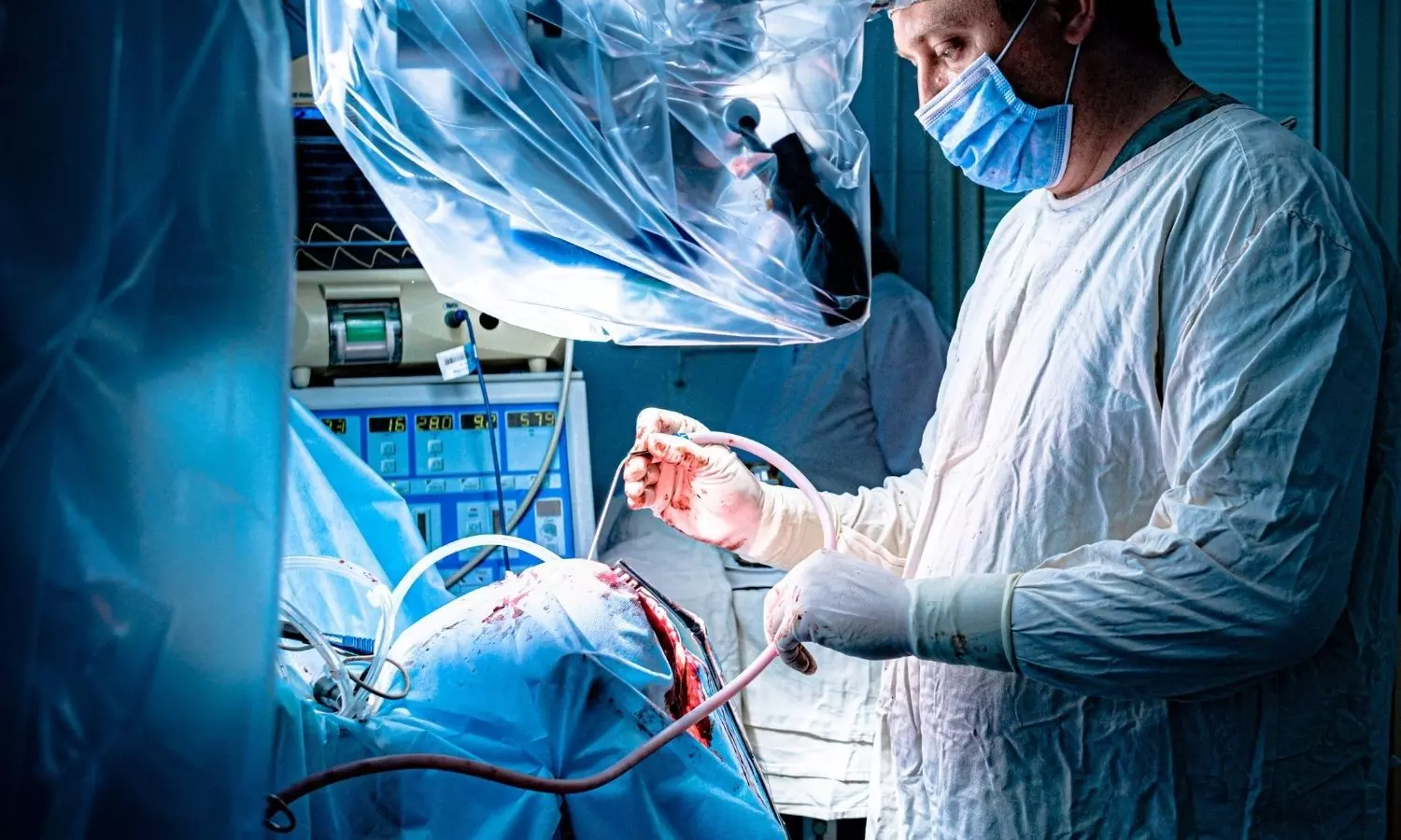 High-Risk Heart Surgery Successfully Managed with Advanced Airway Technique High-Risk Heart Surgery Successfully Managed with Advanced Airway Technique