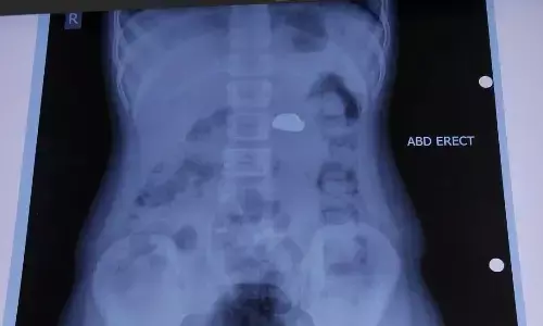 9-Year-Old Swallows 7 Magnets: How a Simple Toy Became Life-Threatening