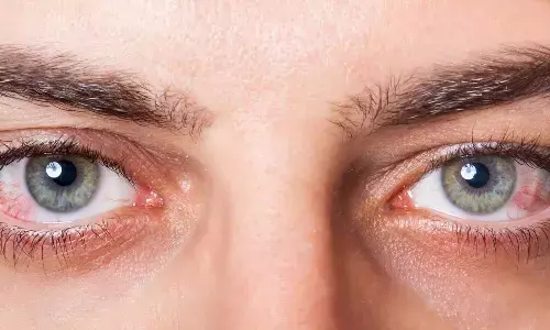 Eye Infections: सर्दियों में क्यों बढ़ जाती है आंखों की समस्या, डॉक्टर ने बताया कारण और उपाय
