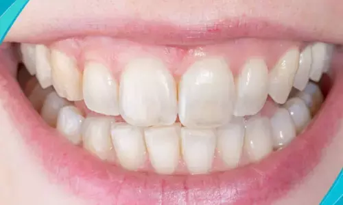 अगरतला गवर्नमेंट डेंटल कॉलेज ने सफल टूथ रिइम्प्लांटेशन से लोगों के चेहरों पर लौटाई मुस्कान