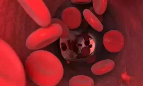 आयुर्वेद के 3 उपाय दूर करेंगे एनीमिया की परेशानी, रखना होगा कुछ विशेष बातों का ध्यान आयुर्वेद के 3 उपाय दूर करेंगे एनीमिया की परेशानी, रखना होगा कुछ विशेष बातों का ध्यान