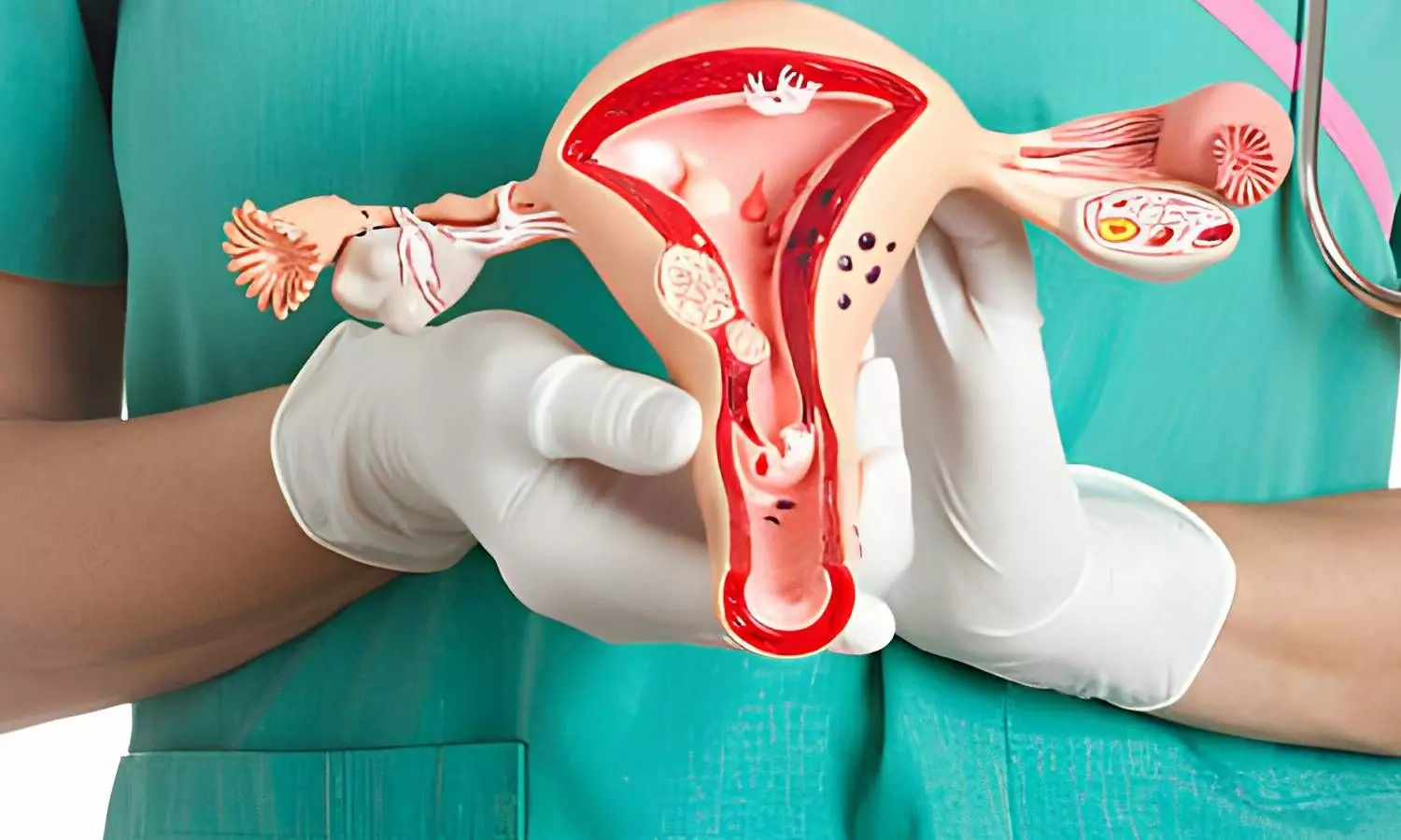 सर्वाइकल कैंसर, भारत में महिलाओं के लिए बड़ा खतरा, जानें क्यों जरूरी है समय पर जांच और टीकाकरण