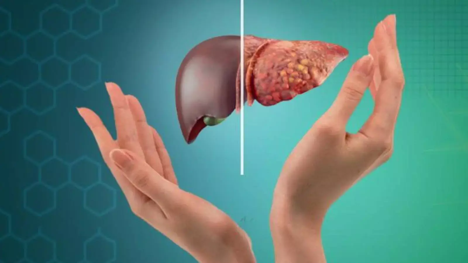 फैटी लीवर की पहचान अब होगी आसान, TyGWHtR इंडेक्स बुजुर्गों में लीवर की बीमारी का सटीक संकेत फैटी लीवर की पहचान अब होगी आसान, TyGWHtR इंडेक्स बुजुर्गों में लीवर की बीमारी का सटीक संकेत