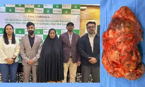 12 Kg Cancerous Gastric Tumour Successfully Removed from a 67-Year-Old Ethiopian Woman in a Rare, High-Risk Surgery