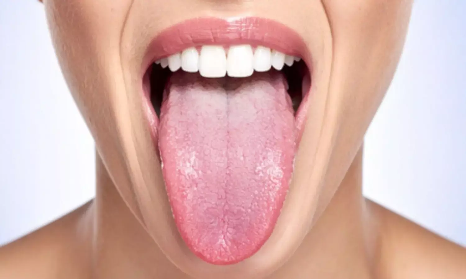 हल्के में न ले सफेद जीभ की परेशानी, देती है शरीर की आंतरिक बीमारियों का संकेत