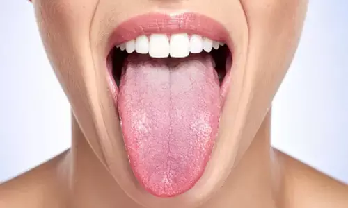 हल्के में न ले सफेद जीभ की परेशानी, देती है शरीर की आंतरिक बीमारियों का संकेत