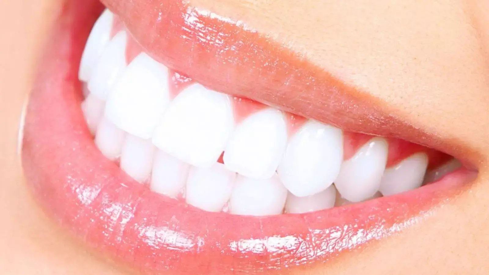 दांतों के कीड़े और खोखलेपन से हैं परेशान? डॉ. ने बताया 5 घरेलू नुस्खे जो दिलाएंगे तुरंत आराम