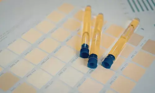 17-कीटोस्टेरॉइड्स(17-Ketosteroids) मूत्र जाँच - जानने योग्य ज़रूरी टिप्स क्या है? 17-कीटोस्टेरॉइड्स(17-Ketosteroids) मूत्र जाँच - जानने योग्य ज़रूरी टिप्स क्या है?