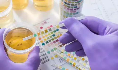 What Is a 24-Hour Urine Test?