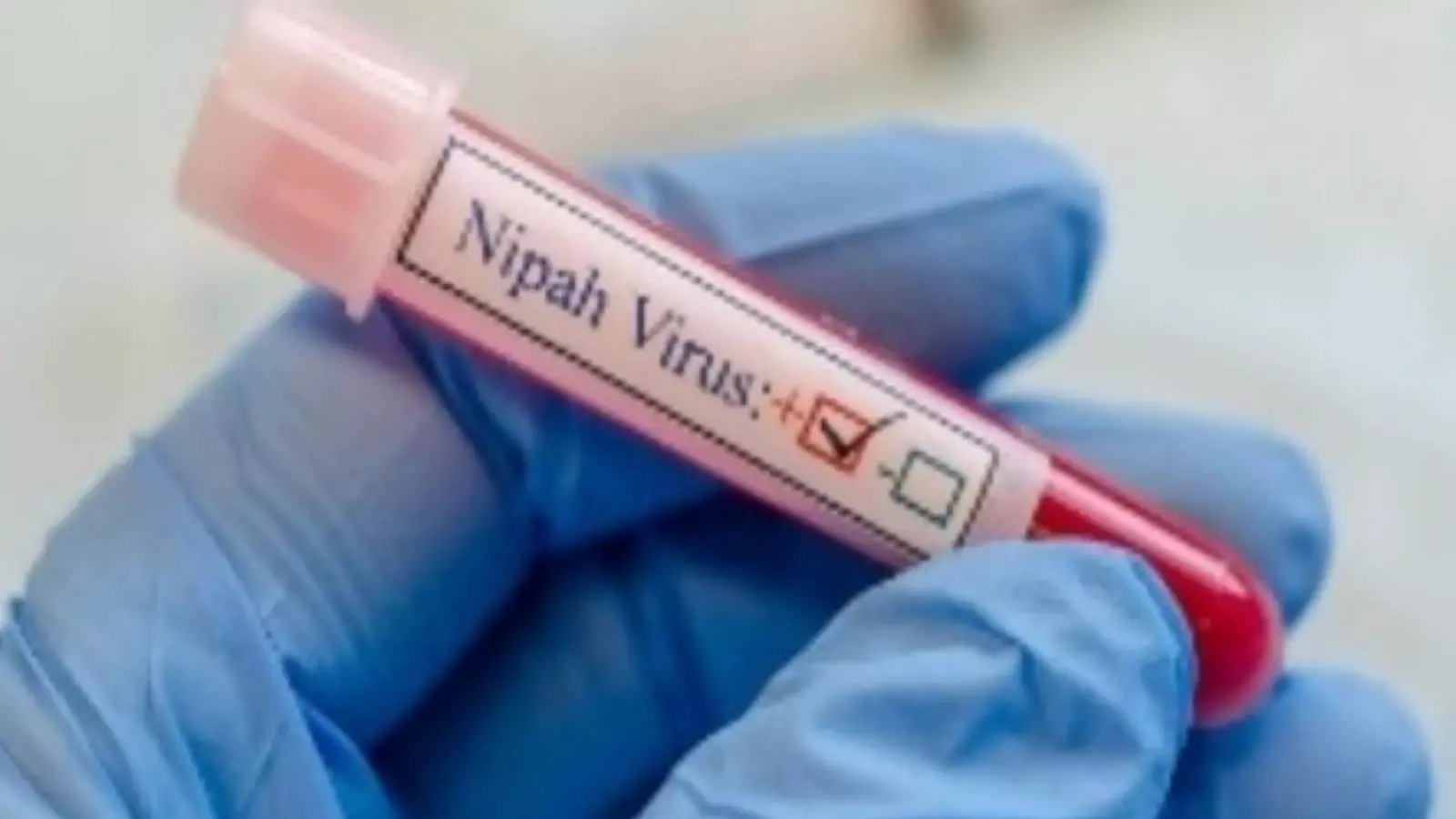 पश्चिम बंगाल में निपाह वायरस से पहली मौत की खबर
