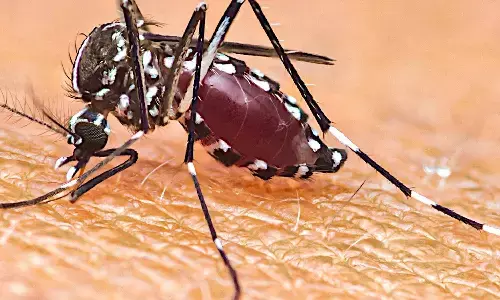 किरण राव को हुआ चिकनगुनिया, किताब उठाना भी हुआ मुश्किल, जानें जोड़ों पर इस वायरस का खतरनाक असर किरण राव को हुआ चिकनगुनिया, किताब उठाना भी हुआ मुश्किल, जानें जोड़ों पर इस वायरस का खतरनाक असर