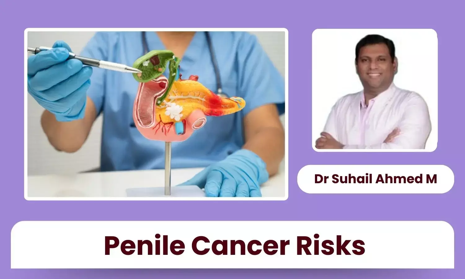 Penile Cancer: Role of Hygiene, Smoking & Sexual Health Habits - Dr Suhail Ahmed M