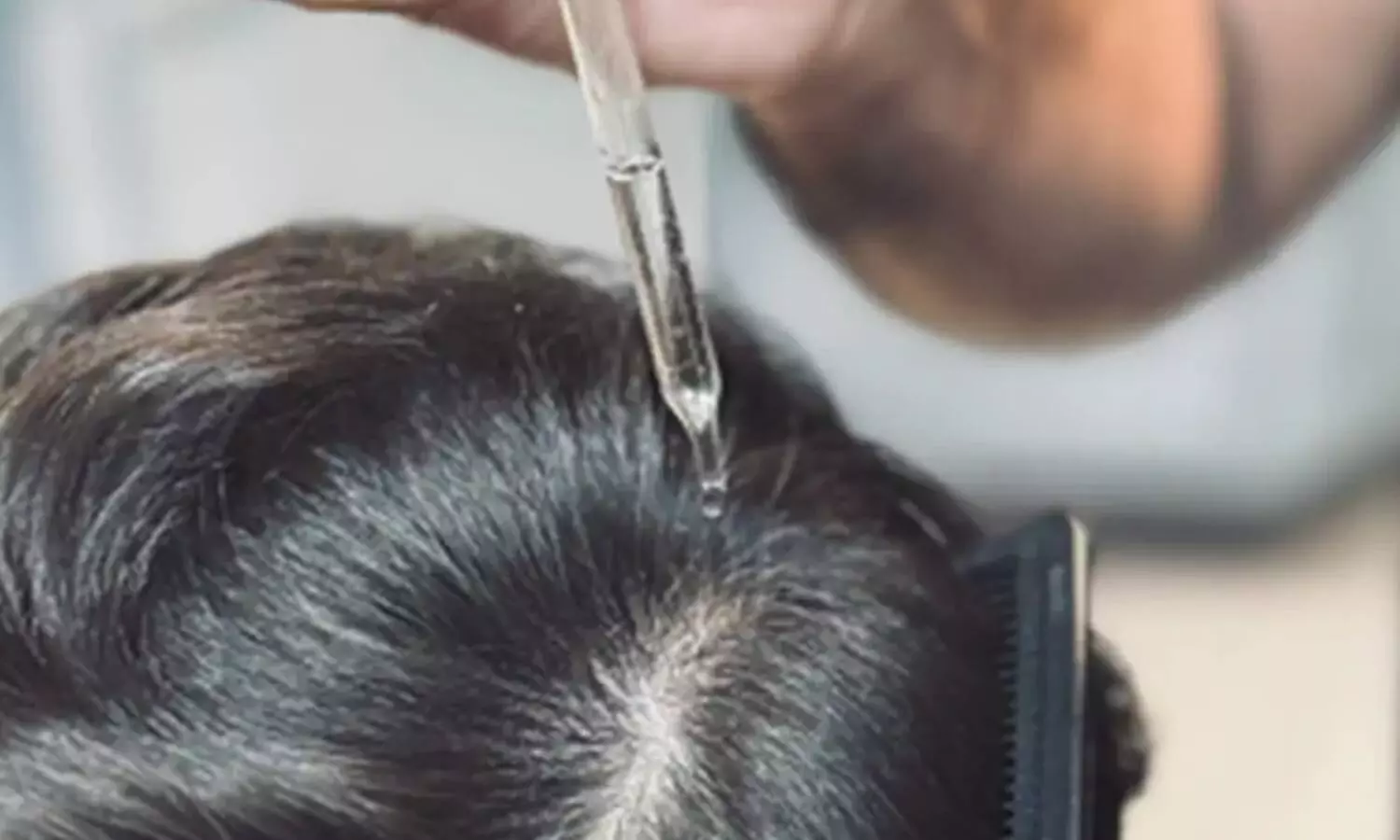 बालों का झड़ना रोकने और जड़ों को फौलादी बनाने के 5 असरदार टिप्स, प्राकृतिक तेलों का जादू बालों का झड़ना रोकने और जड़ों को फौलादी बनाने के 5 असरदार टिप्स, प्राकृतिक तेलों का जादू