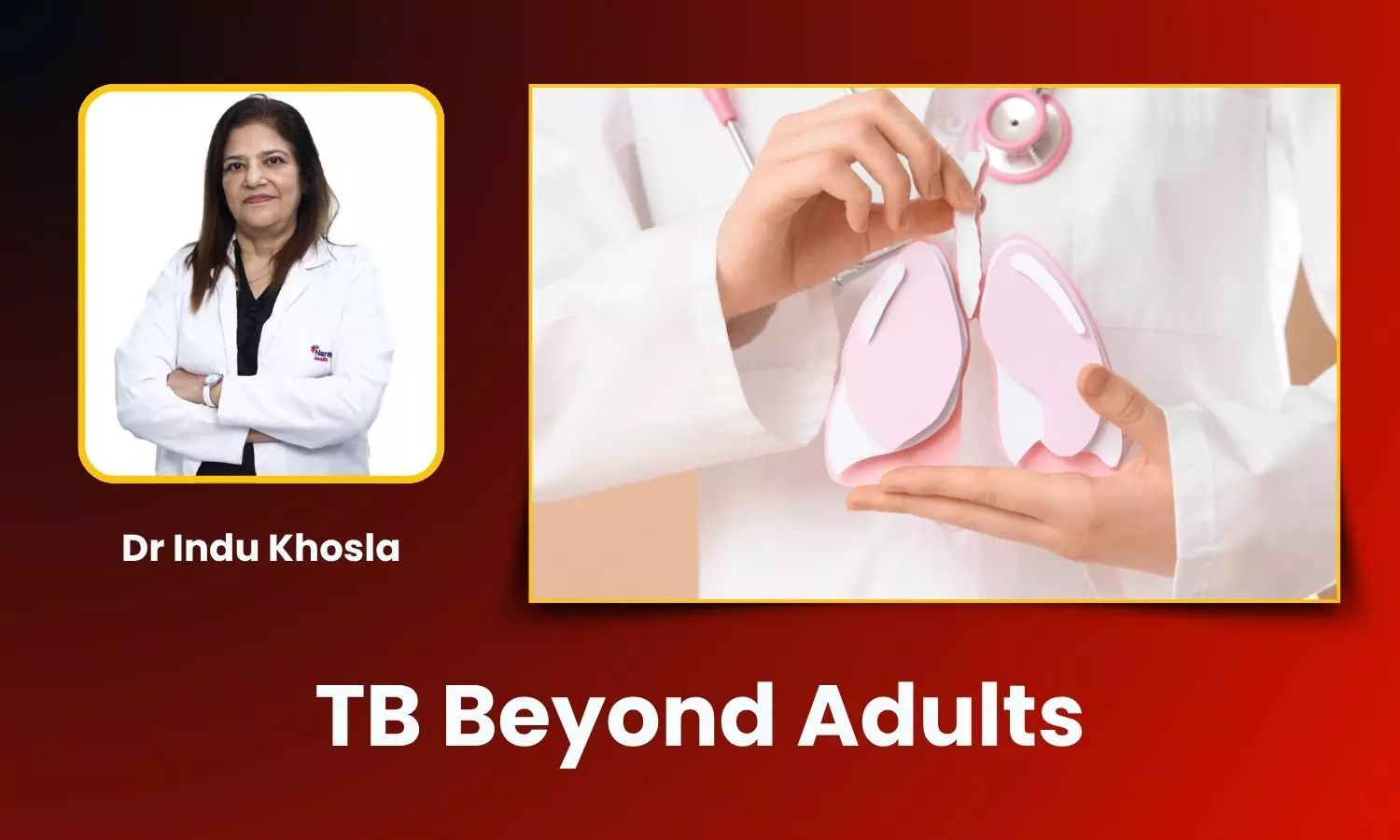 Tuberculosis Is Not Just an Adult Disease - Dr Indu Khosla Tuberculosis Is Not Just an Adult Disease - Dr Indu Khosla